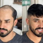 خرید پروتز هالیوودی تعداد بالا عمده 10 عددی (کد:9088)