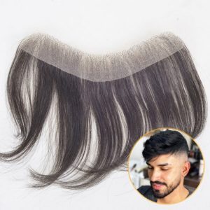 خرید پروتز جلو سر مردانه | طبیعی و بدون مرز (کد:3018)